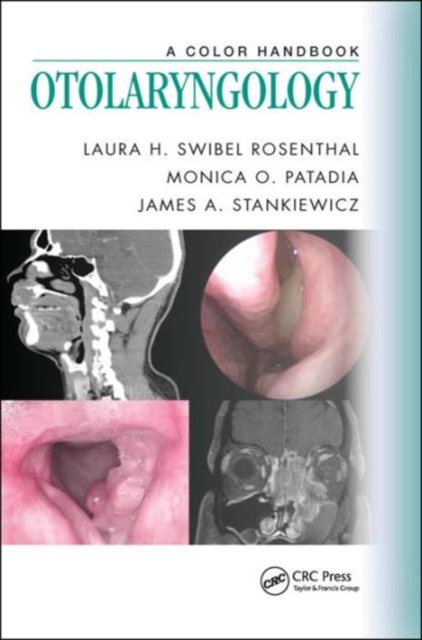 Otolaryngology : A Color Handbook, Paperback / softback Book