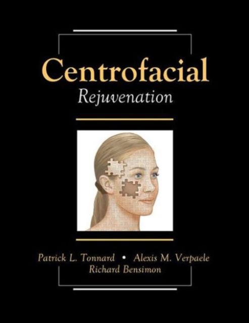 Centrofacial Rejuvenation, Mixed media product Book