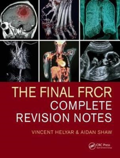 The Final FRCR : Complete Revision Notes, Paperback / softback Book