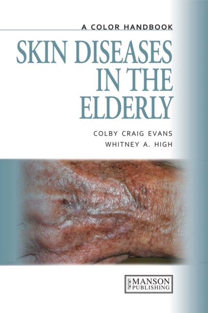 Skin Diseases in the Elderly : A Color Handbook, EPUB eBook