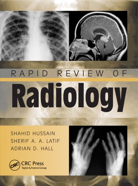 Rapid Review of Radiology, EPUB eBook