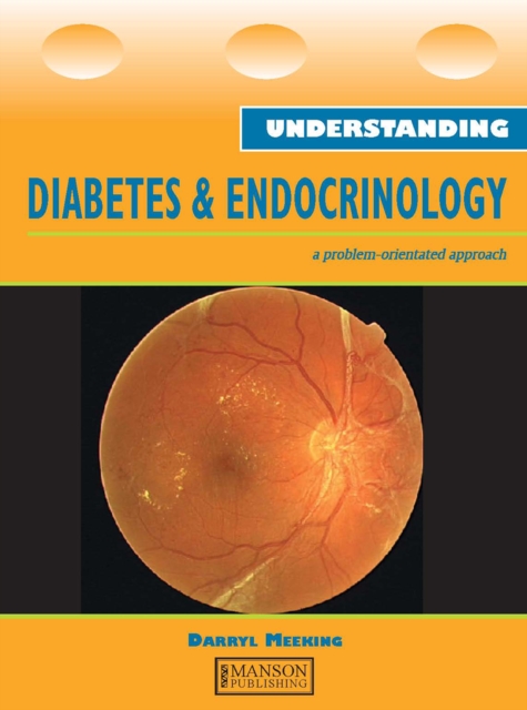 Understanding Diabetes and Endocrinology, EPUB eBook