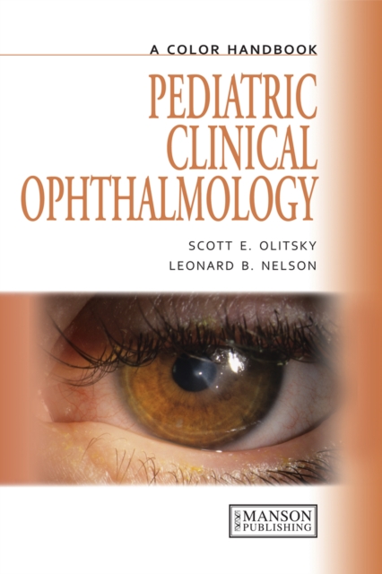 Pediatric Clinical Ophthalmology : A Color Handbook, EPUB eBook