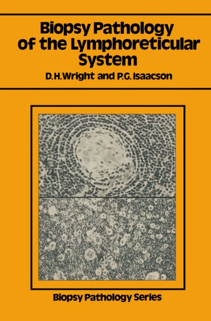 Biopsy Pathology of the Lymphoreticular System, PDF eBook