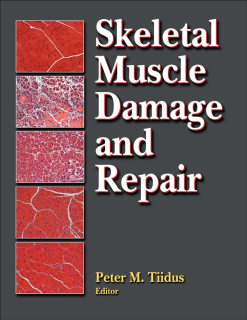 Skeletal Muscle Damage and Repair, PDF eBook