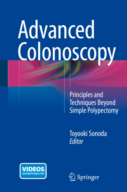 Advanced Colonoscopy : Principles and Techniques Beyond Simple Polypectomy, PDF eBook