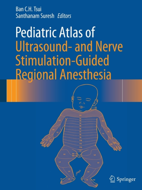 Pediatric Atlas of Ultrasound- and Nerve Stimulation-Guided Regional Anesthesia, Paperback / softback Book