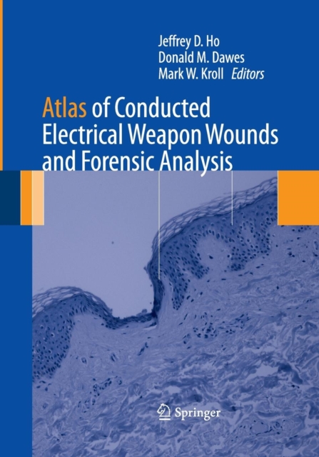 Atlas of Conducted Electrical Weapon Wounds and Forensic Analysis, Paperback / softback Book