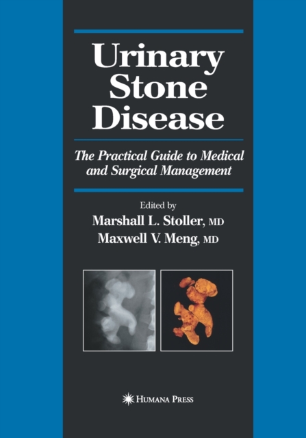Urinary Stone Disease : The Practical Guide to Medical and Surgical Management, Paperback / softback Book