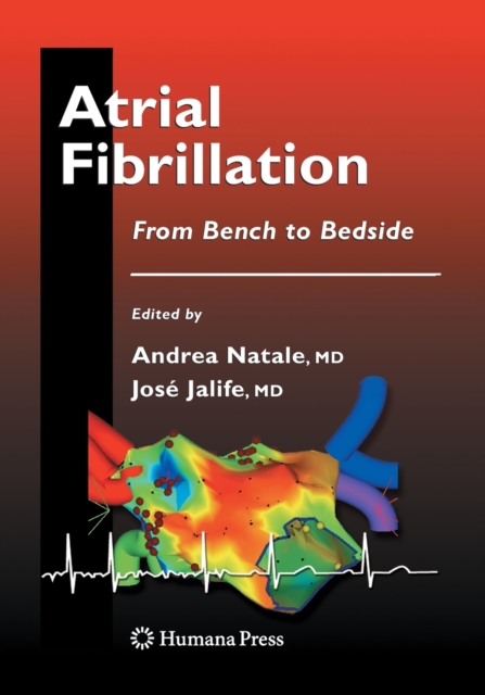 Atrial Fibrillation : From Bench to Bedside, Paperback / softback Book