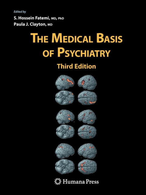 The Medical Basis of Psychiatry, Paperback / softback Book