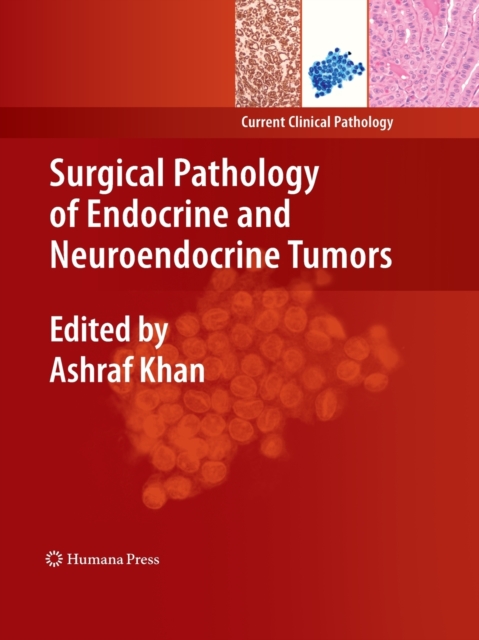 Surgical Pathology of Endocrine and Neuroendocrine Tumors, Paperback / softback Book