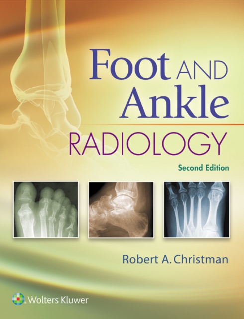 Foot and Ankle Radiology, EPUB eBook