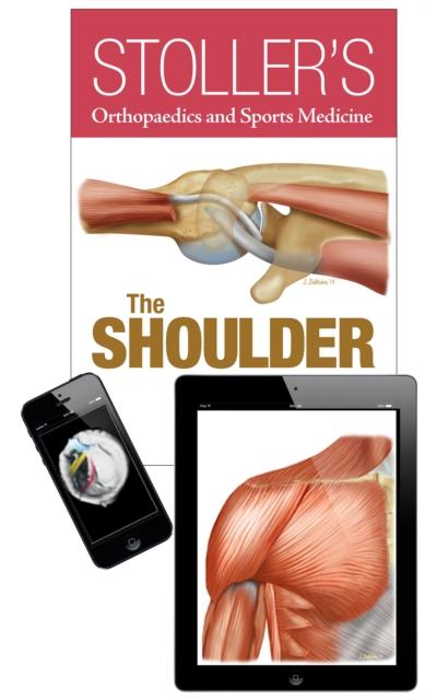 Stoller's Orthopaedics and Sports Medicine: The Shoulder Package, Hardback Book