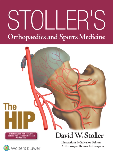 Stoller's Orthopaedics and Sports Medicine: The Hip, Hardback Book