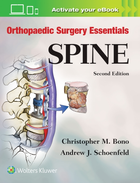 Orthopaedic Surgery Essentials: Spine, Hardback Book