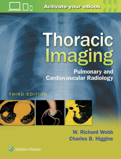 Thoracic Imaging : Pulmonary and Cardiovascular Radiology, Hardback Book