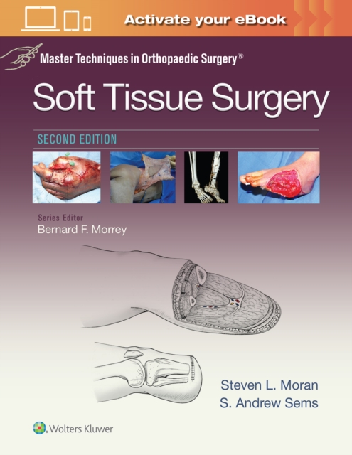 Master Techniques in Orthopaedic Surgery: Soft Tissue Surgery, Hardback Book
