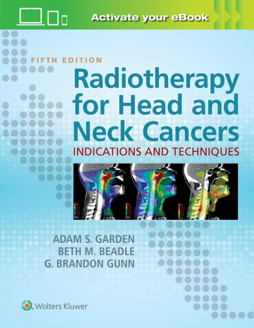 Radiotherapy for Head and Neck Cancers : Indications and Techniques, Hardback Book