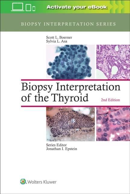 Biopsy Interpretation of the Thyroid, Hardback Book