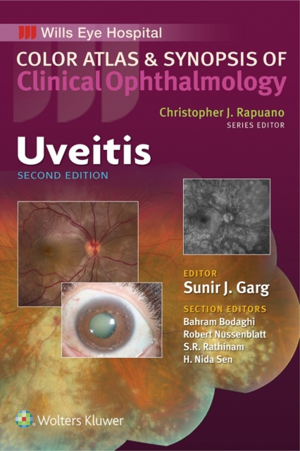 Uveitis, EPUB eBook