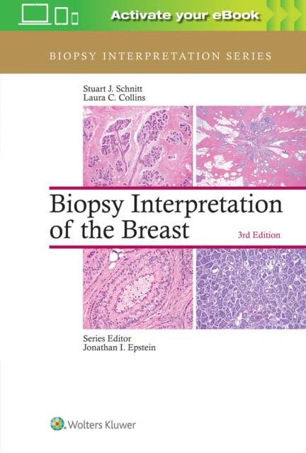 Biopsy Interpretation of the Breast, Hardback Book