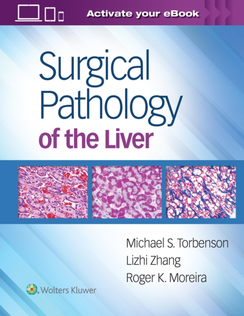 Surgical Pathology of the Liver, Hardback Book