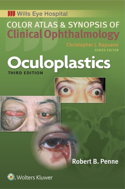 Oculoplastics, EPUB eBook