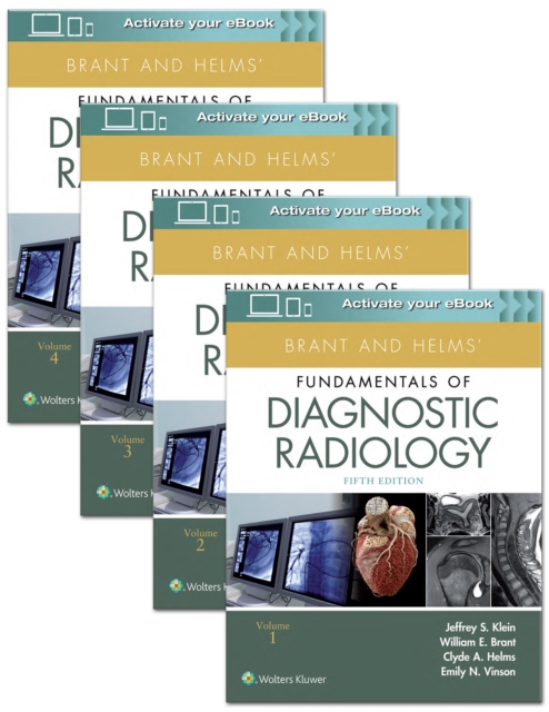 Brant and Helms' Fundamentals of Diagnostic Radiology, Paperback / softback Book
