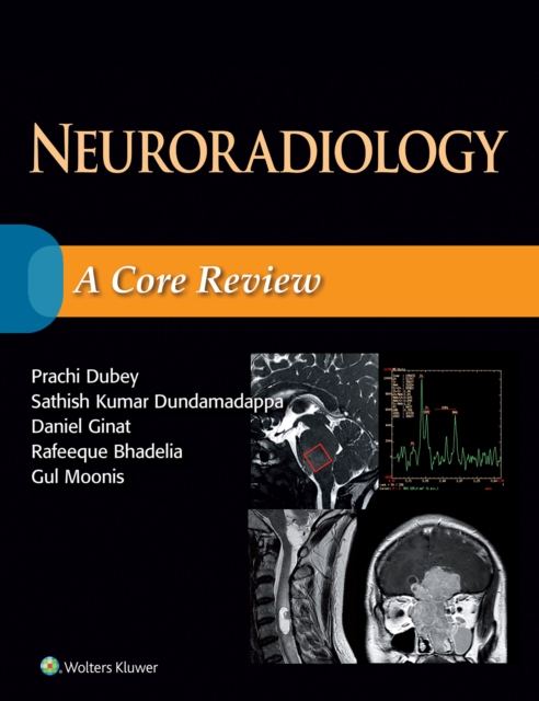 Neuroradiology: A Core Review, EPUB eBook