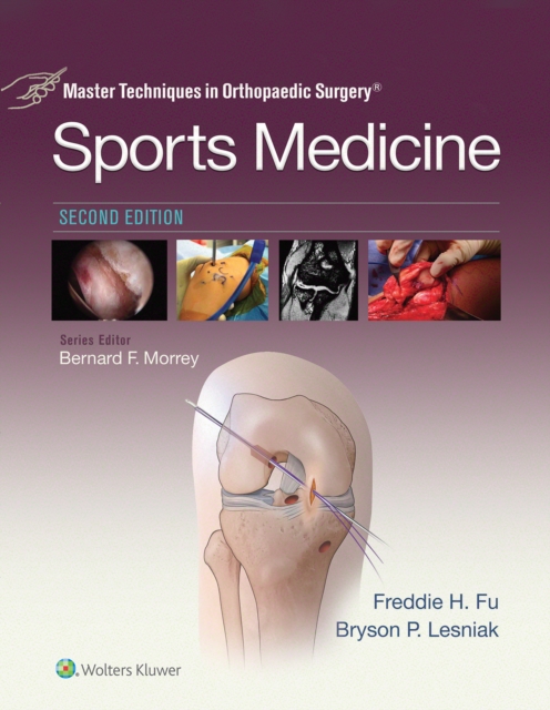 Master Techniques in Orthopaedic Surgery: Sports Medicine, EPUB eBook