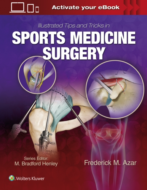 Illustrated Tips and Tricks in Sports Medicine Surgery, Hardback Book