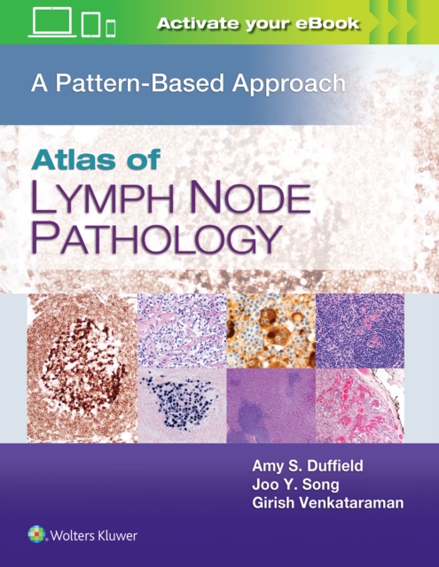 Atlas of Lymph Node Pathology : A Pattern Based Approach, Hardback Book
