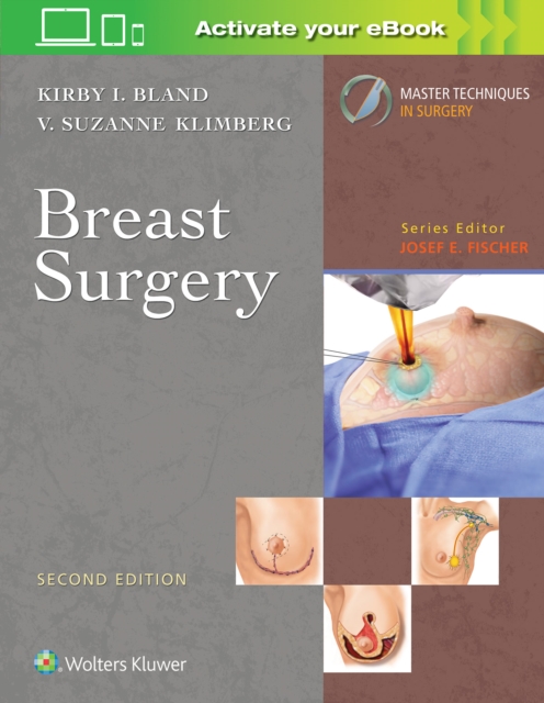 Master Techniques in Surgery: Breast Surgery, Hardback Book