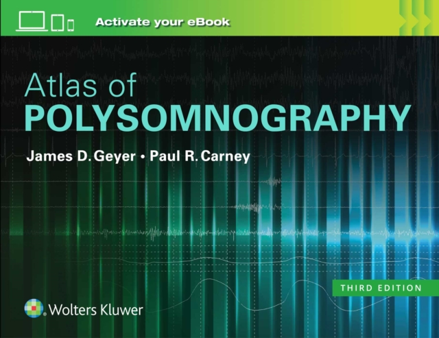 Atlas of Polysomnography, Hardback Book