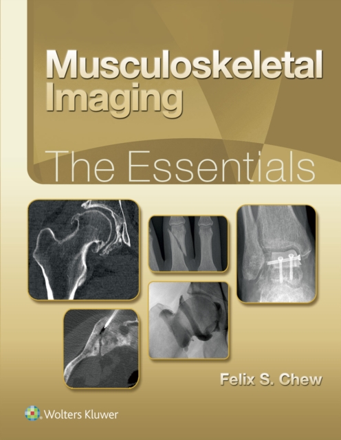 Musculoskeletal Imaging: The Essentials, EPUB eBook