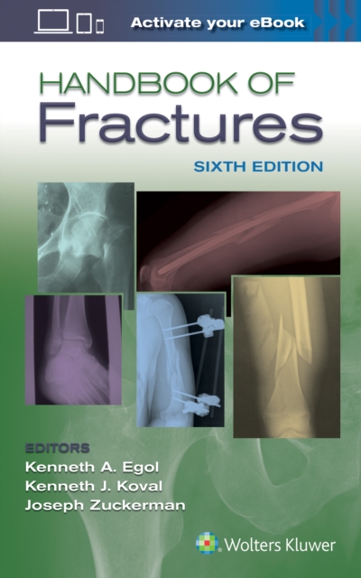 Handbook of Fractures, Paperback / softback Book