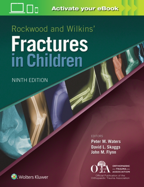 Rockwood and Wilkins Fractures in Children, Hardback Book