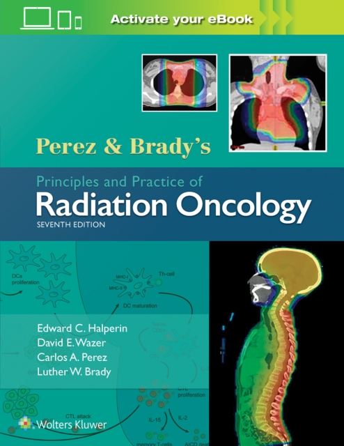Perez & Brady's Principles and Practice of Radiation Oncology, Hardback Book
