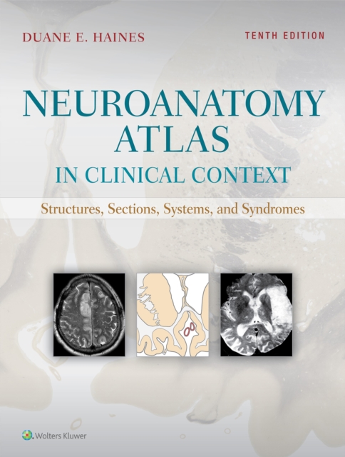 Neuroanatomy Atlas in Clinical Context : Structures, Sections, Systems, and Syndromes, EPUB eBook