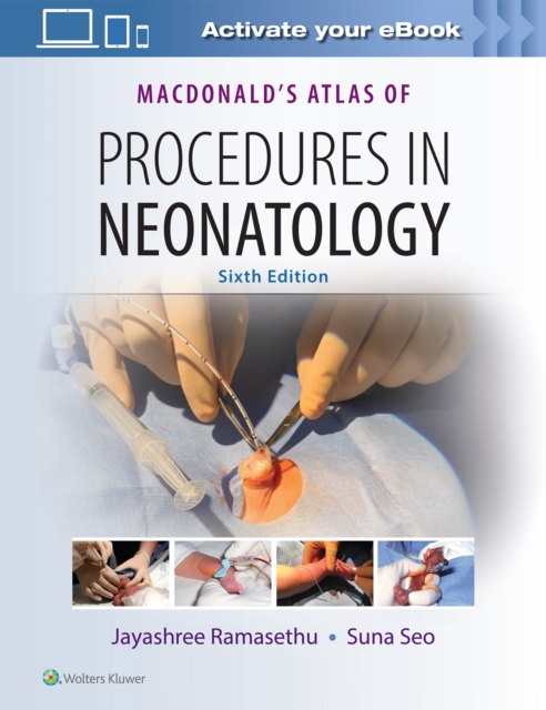 MacDonald's Atlas of Procedures in Neonatology, Hardback Book