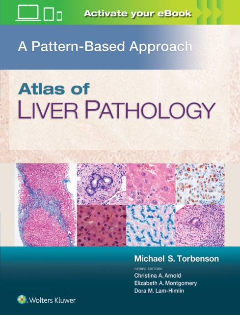 Atlas of Liver Pathology: A Pattern-Based Approach, Hardback Book