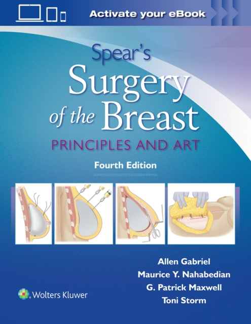 Spear's Surgery of the Breast : Principles and Art, Hardback Book