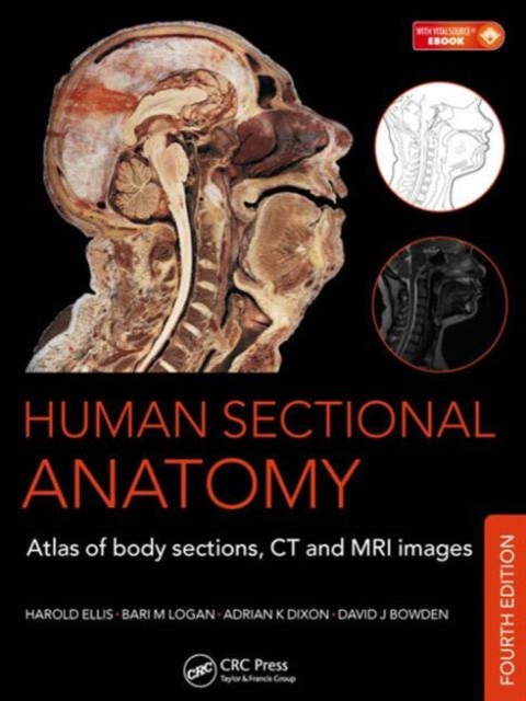 Human Sectional Anatomy : Atlas of Body Sections, CT and MRI Images, Fourth Edition, Hardback Book
