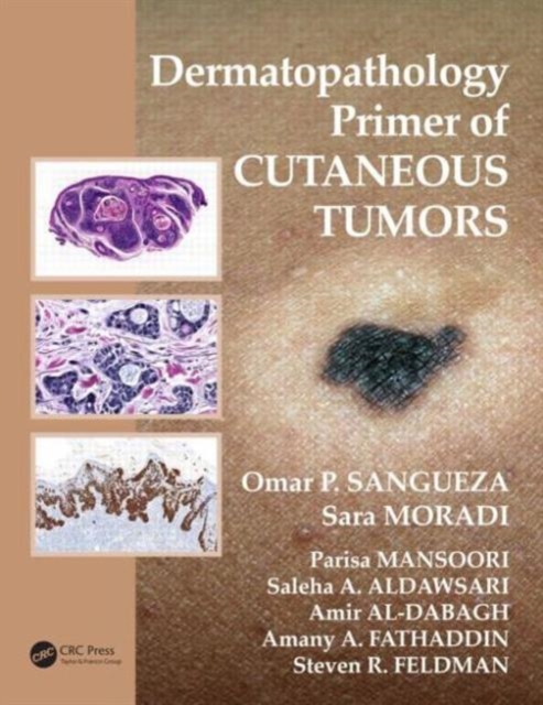 Dermatopathology Primer of Cutaneous Tumors, Paperback / softback Book