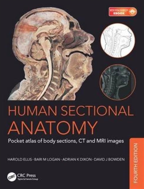Human Sectional Anatomy : Pocket atlas of body sections, CT and MRI images, Fourth edition, Paperback / softback Book