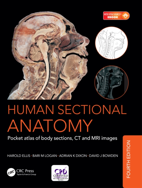 Human Sectional Anatomy : Pocket atlas of body sections, CT and MRI images, Fourth edition, EPUB eBook