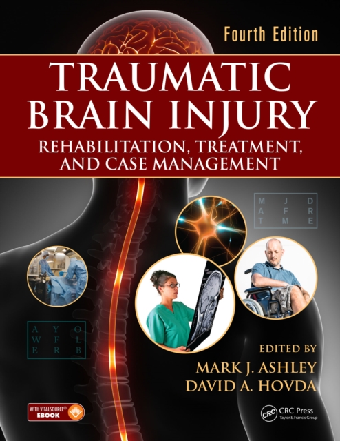 Traumatic Brain Injury : Rehabilitation, Treatment, and Case Management, Fourth Edition, PDF eBook