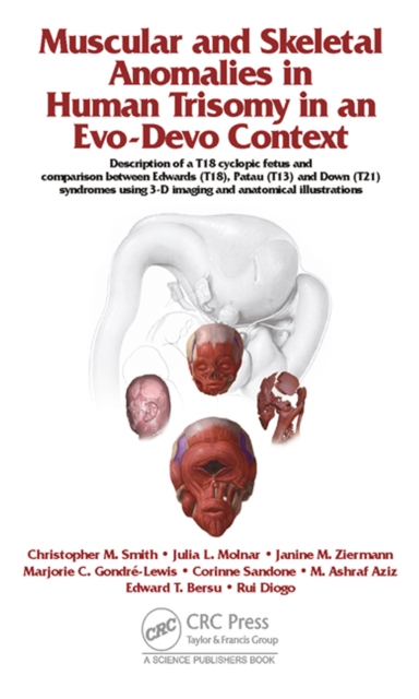 Muscular and Skeletal Anomalies in Human Trisomy in an Evo-Devo Context : Description of a T18 Cyclopic Fetus and Comparison Between Edwards (T18), Patau (T13) and Down (T21) Syndromes Using 3-D Imagi, PDF eBook