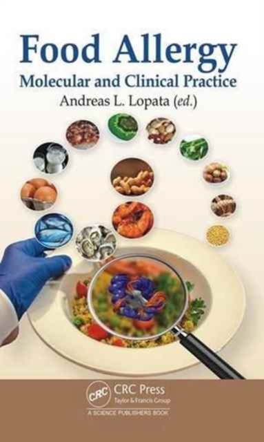Food Allergy : Molecular and Clinical Practice, Hardback Book